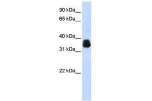 Image no. 1 for anti-AIMP1 / EMAP II (AA 108-157) antibody (ABIN6742988) (AIMP1 / EMAP II (AA 108-157) 抗体)