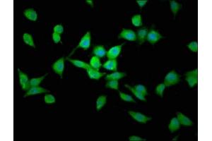 Immunofluorescence (IF) image for anti-Lysosomal Protein Transmembrane 4 beta (LAPTM4B) (AA 174-226) antibody (ABIN7158792)