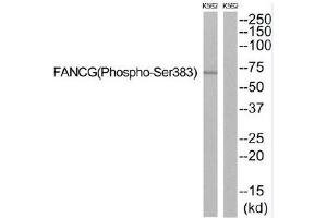 Western blot analysis of extracts from K562 cells, using FANCG (Phospho-Ser383) antibody. (FANCG 抗体  (pSer383))