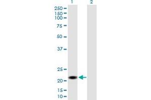 Western Blot analysis of CSH2 expression in transfected 293T cell line by CSH2 MaxPab polyclonal antibody. (CSH1 抗体  (AA 1-217))