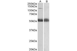 ABIN5539511 (0. (COPA 抗体  (Internal Region))