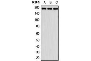 Western blot analysis of Fibulin 2 expression in HeLa (A), SP2/0 (B), H9C2 (C) whole cell lysates. (FBLN2 抗体  (Center))