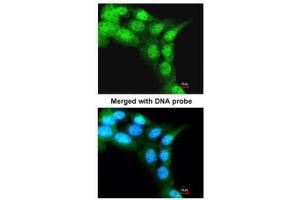 ICC/IF Image Immunofluorescence analysis of paraformaldehyde-fixed A431, using FBXL3, antibody at 1:200 dilution. (FBXL3 抗体)