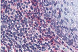 Human Tonsil: Formalin-Fixed, Paraffin-Embedded (FFPE) (JNK2 抗体  (AA 1-425))