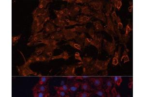 Immunofluorescence analysis of C6 cells using ABCB11 Polyclonal Antibody at dilution of 1:100. (ABCB11 抗体)