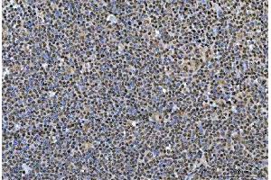 IHC analysis of SNRPN using anti-SNRPN antibody (ABIN3043934).