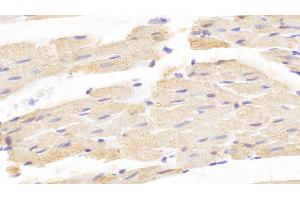 Immunohistochemistry (IHC) image for anti-Corticotropin Releasing Hormone Binding Protein (CRHBP) (AA 25-322) antibody (ABIN7434878)