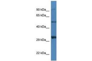 Image no. 1 for anti-Sarcoglycan, delta (35kDa Dystrophin-Associated Glycoprotein) (SGCD) (AA 37-86) antibody (ABIN6746239) (SGCD 抗体  (AA 37-86))