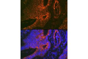 Immunofluorescence (IF) image for anti-ADAM Metallopeptidase Domain 15 (ADAM15) antibody (ABIN7265434)