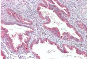 Human Uterus: Formalin-Fixed, Paraffin-Embedded (FFPE) (MYF5 抗体  (AA 7-36))