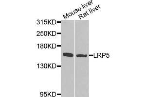 Western blot analysis of extracts of various cell lines, using LRP5 antibody (ABIN5974915) at 1/1000 dilution.