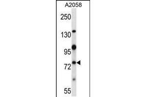 Western blot analysis in A2058 cell line lysates (35ug/lane). (NEK8 抗体  (C-Term))