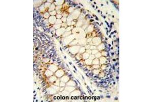 Immunohistochemistry (IHC) image for anti-serine/arginine-Rich Splicing Factor 1 (SRSF1) antibody (ABIN3002838) (SRSF1 抗体)
