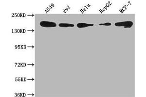 Western Blot Positive WB detected in: A549 whole cell lysate, 293 whole cell lysate, Hela whole cell lysate, HepG2 whole cell lysate, MCF-7 whole cell lysate All lanes: PLXNB2 antibody at 1:1000 Secondary Goat polyclonal to rabbit IgG at 1/50000 dilution Predicted band size: 206 kDa Observed band size: 206 kDa (Plexin B2 抗体  (AA 1458-1673))