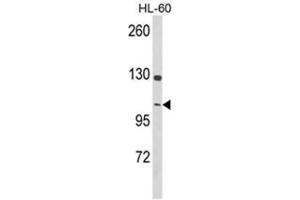 Western blot analysis of Dynamin 3 Antibody (Center) in HL-60 cell line lysates (35ug/lane). (Dynamin 3 抗体  (Middle Region))