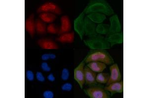 ABIN6260720 and ABIN6276822 staining Hela cells by IF/ICC. (CDK7 抗体  (Internal Region))