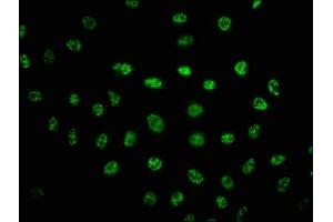 Immunofluorescence staining of Hela cells(treated with UV) with ABIN7127732 at 1:100,counter-stained with DAPI. (Recombinant PRKDC 抗体  (pSer2056))