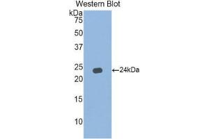 Western Blotting (WB) image for anti-Interferon, alpha 5 (IFNA5) (AA 24-189) antibody (ABIN1859267) (IFNA5 抗体  (AA 24-189))