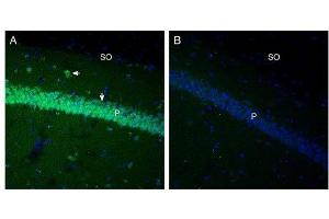 Expression of GPR91 in mouse hippocampus. (SUCNR1 抗体  (3rd Extracellular Loop))