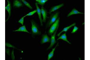 Immunofluorescence staining of Hela cells with ABIN7156276 at 1:66, counter-stained with DAPI.