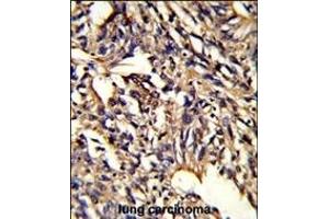 Immunohistochemistry (Paraffin-embedded Sections) (IHC (p)) image for anti-Proteasome (Prosome, Macropain) 26S Subunit, Non-ATPase, 13 (PSMD13) (AA 269-298), (C-Term) antibody (ABIN389455)