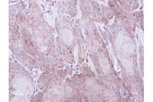 IHC-P Image Immunohistochemical analysis of paraffin-embedded Cal27 xenograft, using SEC61A1, antibody at 1:500 dilution.