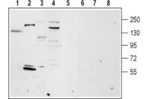 Western blot analysis of rat lung (lanes 1 and 5), rat heart membrane (lanes 2 and 6), mouse brain membrane (lanes 3 and 7) and ms1 mouse pancreas cells lysate (lanes 4 and 8): - 1-4. (TRPM4 抗体  (Intracellular, N-Term))