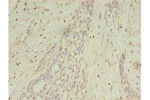 Immunohistochemistry (IHC) image for anti-Melanoma Antigen Family A, 1 (Directs Expression of Antigen MZ2-E) (MAGEA1) (AA 2-225) antibody (ABIN7159252)