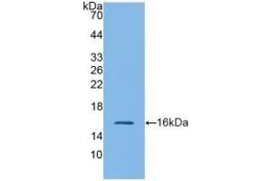 Detection of Recombinant GLP1R, Mouse using Polyclonal Antibody to Glucagon Like Peptide 1 Receptor (GLP1R) (GLP1R 抗体  (AA 25-145))