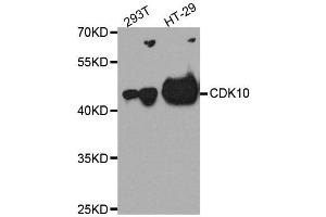 Western blot analysis of extracts of various cell lines, using CDK10 antibody. (CDK10 抗体  (AA 1-283))