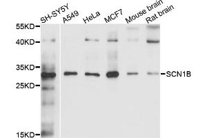 Western blot analysis of extracts of various cell lines, using SCN1B antibody (ABIN4905094) at 1:1000 dilution. (SCN1B 抗体)