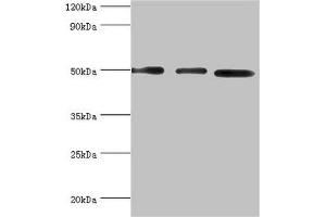 Western blot All lanes: Adenylosuccinate synthetase isozyme 2 antibody at 12 μg/mL Lane 1: Mouse skeletal muscle tissue Lane 2: HepG2 whole cell lysate Lane 3: K562 whole cell lysate Secondary Goat polyclonal to rabbit IgG at 1/10000 dilution Predicted band size: 50 kDa Observed band size: 50 kDa (ADSS 抗体  (AA 1-280))