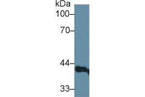 Western Blot; Sample: Rat Serum; Primary Ab: 1µg/ml Rabbit Anti-Rat LEDGF Antibody Second Ab: 0. (PSIP1 抗体  (AA 311-469))