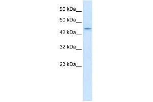 Western Blot showing ZNF651 antibody used at a concentration of 1-2 ug/ml to detect its target protein. (ZBTB47 抗体  (N-Term))