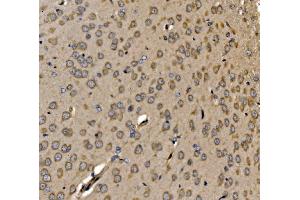 IHC analysis of SRP72 using anti-SRP72 antibody (ABIN7601648). (SRP72 抗体  (AA 40-460))
