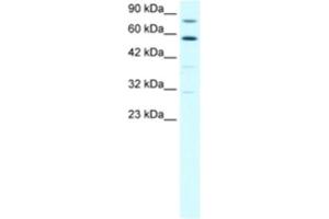 Western Blotting (WB) image for anti-Staphylococcal Nuclease Domain Containing Protein 1 (SND1) antibody (ABIN2460503) (SND1 抗体)