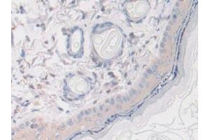 Immunohistochemistry (IHC) image for anti-serpin Peptidase Inhibitor, Clade A (Alpha-1 Antiproteinase, Antitrypsin), Member 10 (SERPINA10) (AA 278-425) antibody (ABIN7438085)