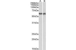 ABIN2564428 (1µg/ml) staining of nuclear NIH3T3 (A) and nuclear HeLa (B) lysates (35µg protein in RIPA buffer). (PDCD4 抗体  (Internal Region))
