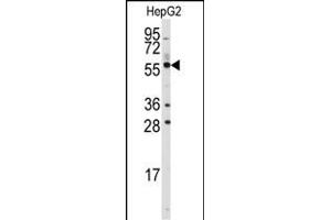 Western Blotting (WB) image for anti-Aldehyde Dehydrogenase 4 Family, Member A1 (ALDH4A1) (AA 533-561), (C-Term) antibody (ABIN392356)