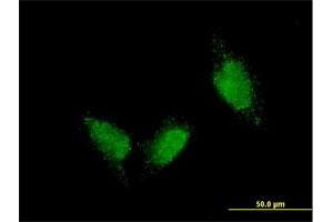 Immunofluorescence (IF) image for anti-Titin (TTN) (AA 1-110) antibody (ABIN563285)