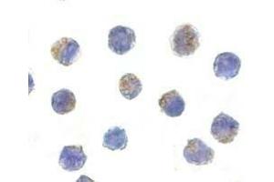 Immunocytochemical staining of AIF in K562 cells with AIF antibody at 5 μg/ml. (AIF 抗体)