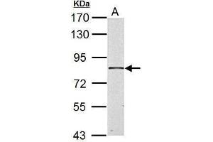 WB Image HSD17B4 antibody detects HSD17B4 protein by Western blot analysis. (HSD17B4 抗体)