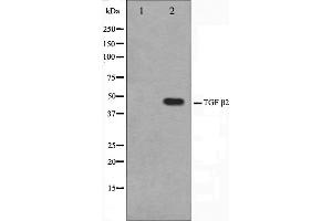 Western blot analysis of TGF beta2 Antibody expression in mouse brain tissue lysates. (TGFB2 抗体  (C-Term))