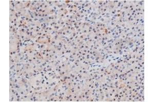 Immunohistochemistry (IHC) image for anti-Signal Transducer and Activator of Transcription 3 (Acute-Phase Response Factor) (STAT3) (pSer727) antibody (ABIN6256411)