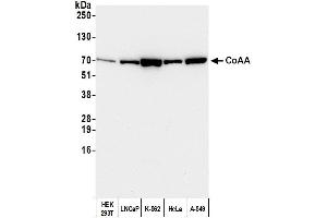 Western Blotting (WB) image for anti-CoaA (AA 550-600) antibody (ABIN7451577) (CoaA (AA 550-600) 抗体)
