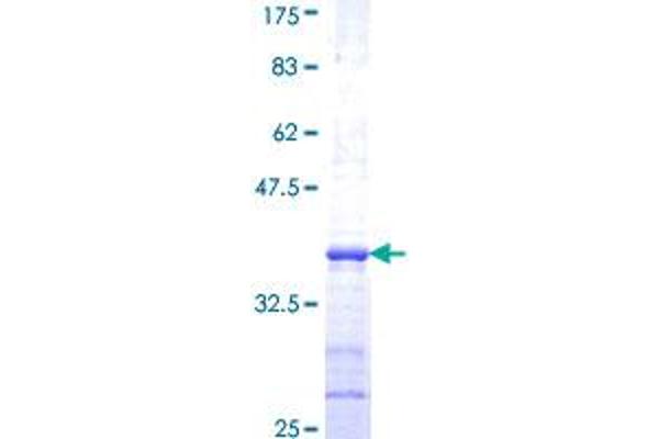 EIF3F Protein (AA 258-357) (GST tag)