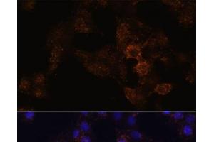 Immunofluorescence analysis of HeLa cells using GRP Polyclonal Antibody at dilution of 1:100. (Gastrin-Releasing Peptide 抗体)