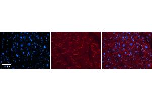 Rabbit Anti-KEAP1 Antibody    Formalin Fixed Paraffin Embedded Tissue: Human Adult heart  Observed Staining: Cytoplasmic (within intercalated disks) Primary Antibody Concentration: 1:600 Secondary Antibody: Donkey anti-Rabbit-Cy2/3 Secondary Antibody Concentration: 1:200 Magnification: 20X Exposure Time: 0. (KEAP1 抗体  (C-Term))