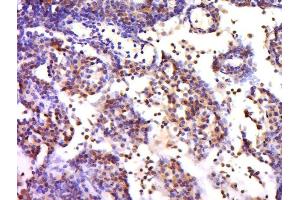 Paraformaldehyde-fixed, paraffin embedded mouse lymph, Antigen retrieval by boiling in sodium citrate buffer (pH6) for 15min, Block endogenous peroxidase by 3% hydrogen peroxide for 30 minutes, Blocking buffer (normal goat serum) at 37°C for 20min, Antibody incubation with 	Rabbit Anti-CX3CR1 Polyclonal Antibody, Unconjugated  at 1:500 overnight at 4°C, followed by a conjugated secondary and DAB staining. (CX3CR1 抗体  (AA 151-250))