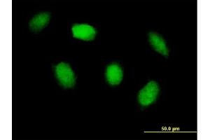 Immunofluorescence of purified MaxPab antibody to HIPK4 on HeLa cell. (HIPK4 抗体  (AA 1-616))